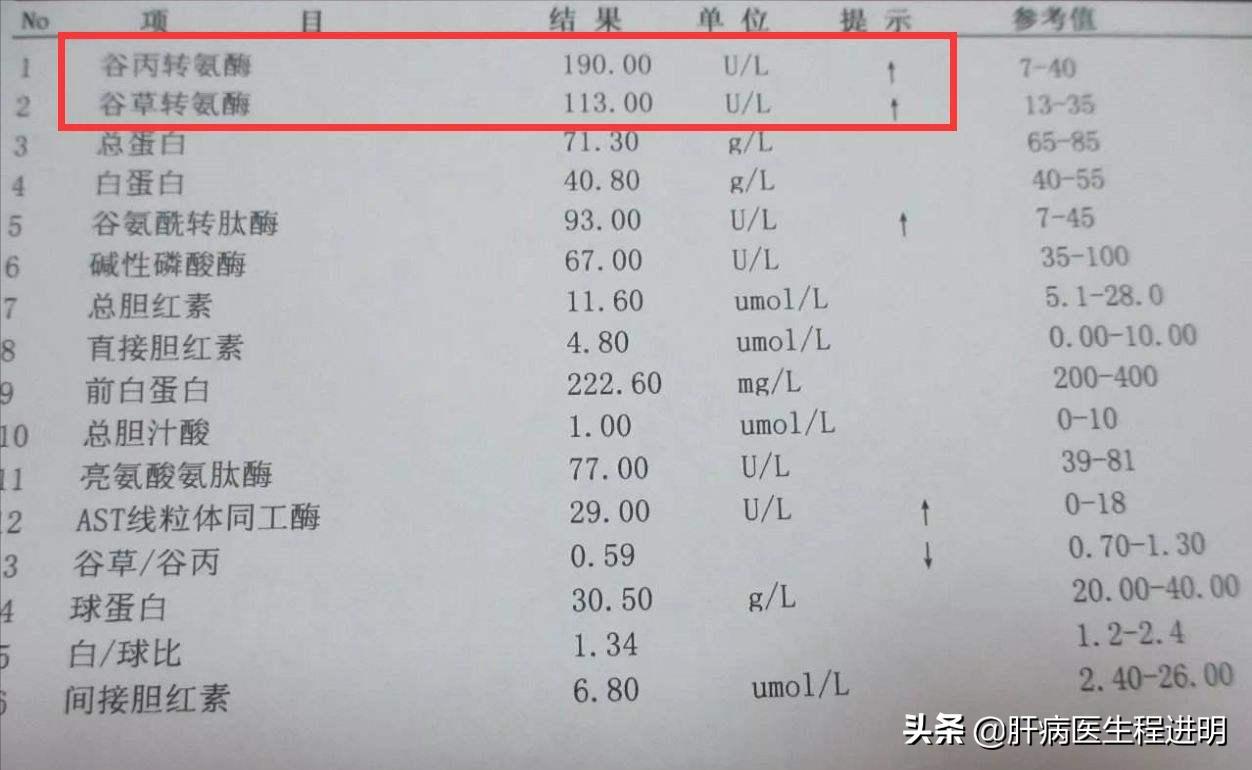 常见保肝护肝药一览,警惕药物性肝损伤