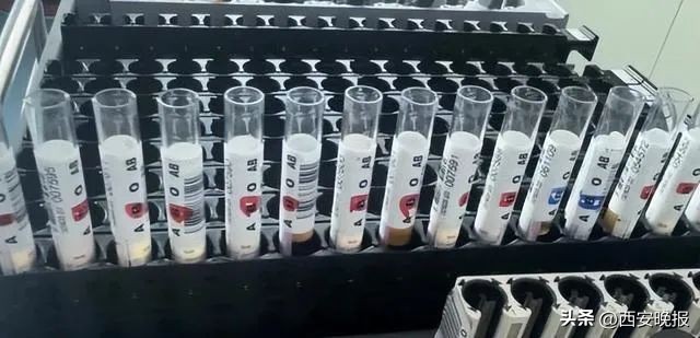 全球最稀有黄金血液,全球罕见黄金血液