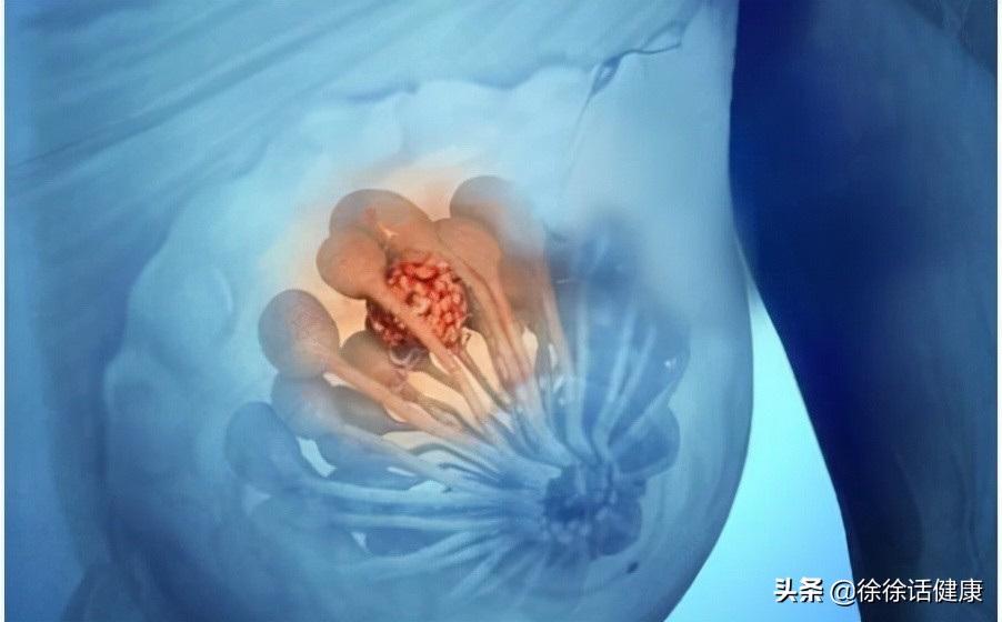 肿瘤标志物正常代表没有癌吗,肿瘤标志物都代表啥