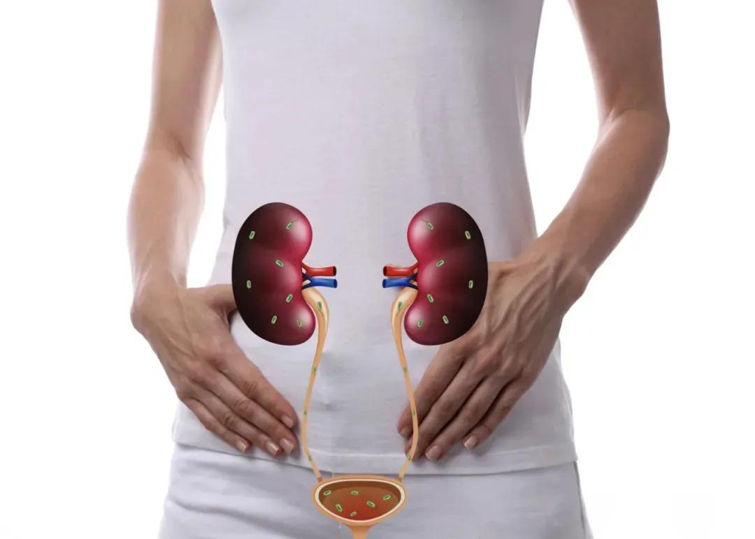 尿路感染预防的8点建议事项,预防尿路感染最有效的方法