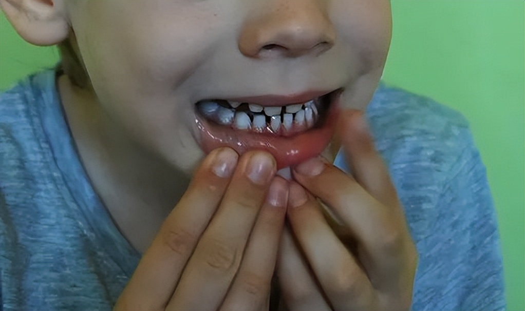 宝宝经常流口水要警惕,宝宝流口水是什么原因要警惕