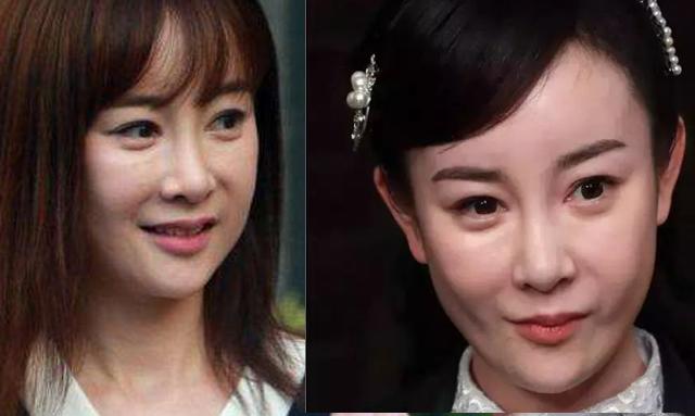 6位被整容毁掉的女星,整容把脸整得很奇怪的女星