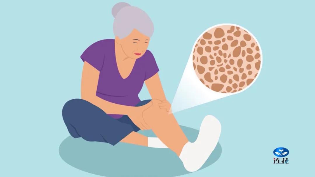 骨折躺100天,骨折躺床上一个月的后果