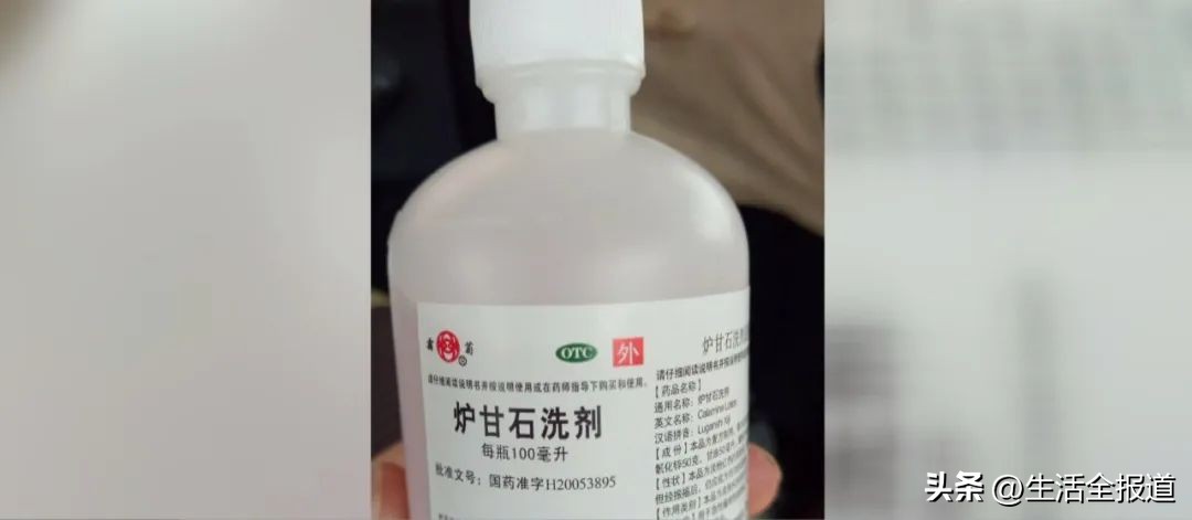 有什么老方法可以快速止痒蚊子包,怎么给蚊子包止痒