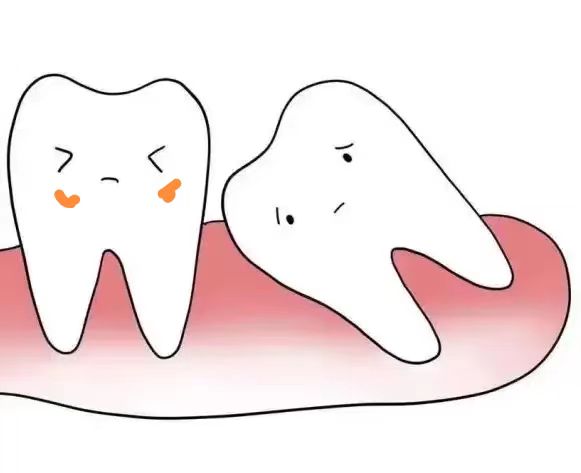 意外撞了乳牙法律怎么赔偿,意外碰伤他人的最佳处理方式