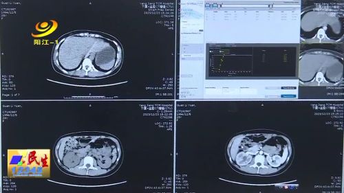 中医治疗浅表静脉畸形,肾动静脉畸形的介入治疗