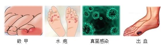 【健康遵义】糖尿病足，伤不起的狠“脚”色！怎么预防？