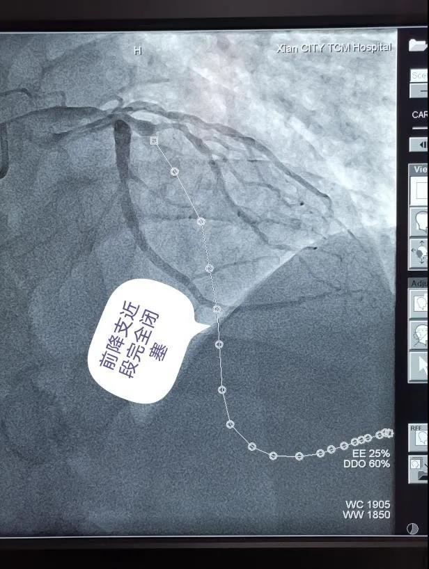 西安市中医医院icu,西安市中医医院oa系统