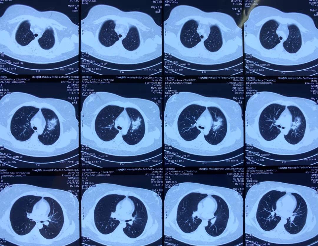 吸猫后感染鹦鹉,养猫感染鹦鹉热