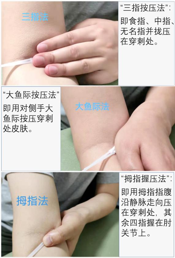 一抽血胳膊就变青是怎么回事,抽血后青了一块是什么原因