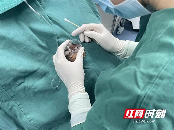 无刀微创青光眼,常德爱尔眼科近视激光手术