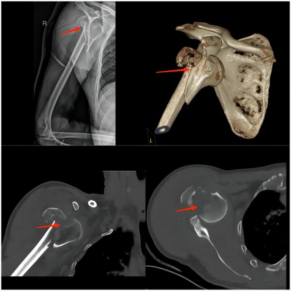 运动损伤知识科普宣传内容,关于足球运动损伤调查问卷