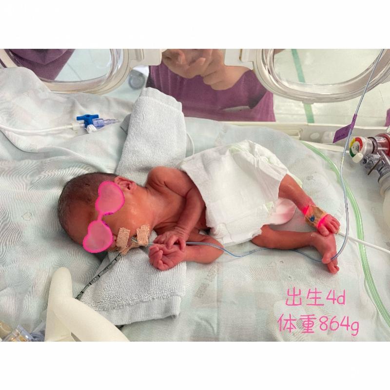 医院抢救26周早产儿后续,深圳早存活的早产儿