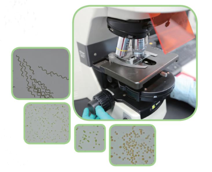 微藻能积累什么,微藻培养的好处
