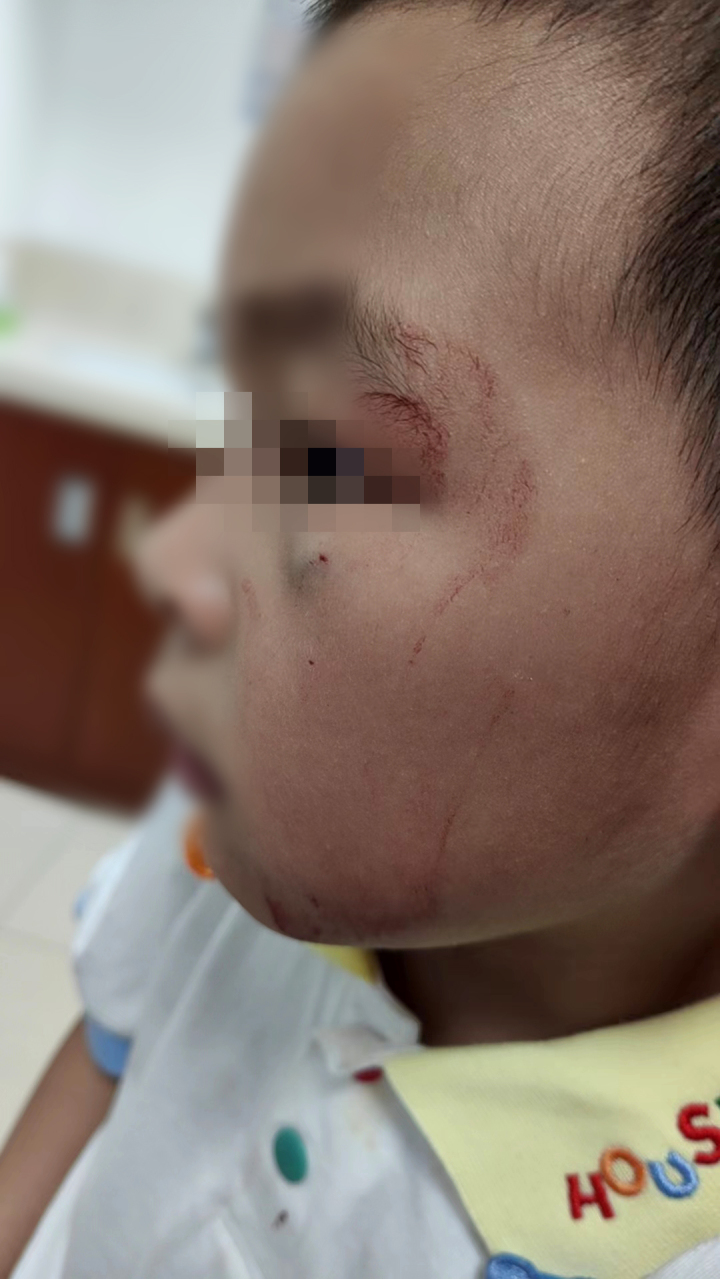 野猫抓伤小孩,抓伤的小猫