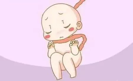 roa胎位脐带绕颈2周能顺产吗,胎儿脐带绕颈还可以进行胎教吗